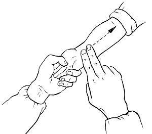 小儿推拿三分钟退烧法图解(小儿推拿发烧退热手法)-1