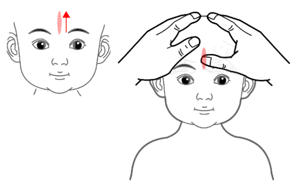 小儿推拿三分钟退烧法图解(小儿推拿发烧退热手法)-1