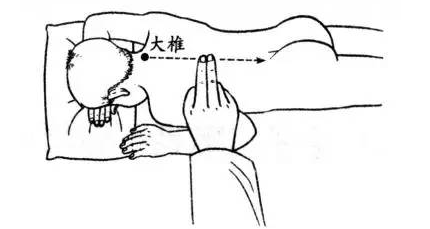 小儿推拿三分钟退烧法图解(小儿推拿发烧退热手法)-1